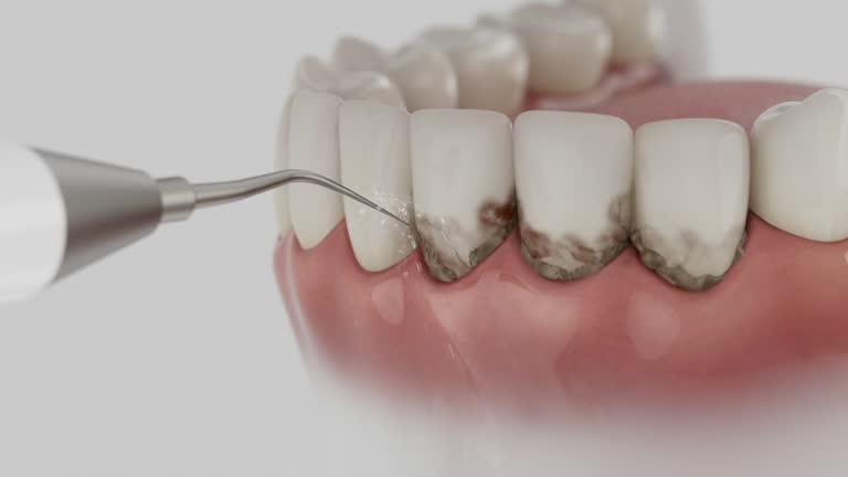 Trusted Tooth Extraction service in Jacinto City, TX - Dentist Open Now